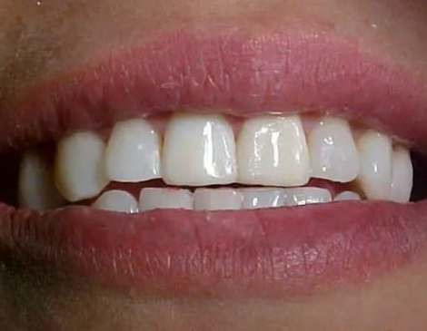 Slider image (7) Smiletec® - Leading Mexicali Dental Clinic